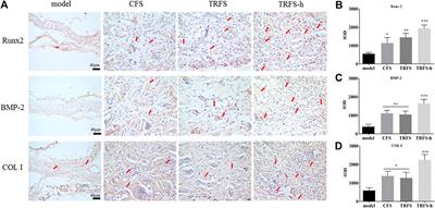 Transforming Growth Factor-β3/Recombinant Human-like Collagen/Chitosan Freeze-Dried Sponge Primed With Human Periodontal Ligament Stem Cells Promotes Bone Regeneration in Calvarial Defect Rats